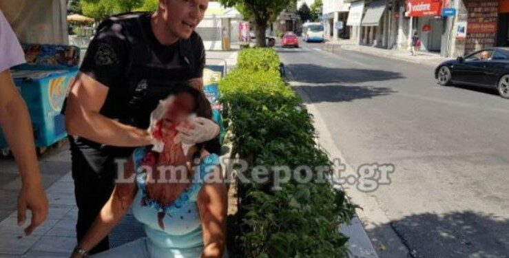 Λαμία: «Βοήθεια, θα με σκοτώσει» – Τη γρονθοκόπησε μέσα στην πλατεία [video]