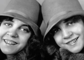 Σιαμαίες που η μία έμεινε έγκυος: Η μάγισσα, η μουσική καριέρα και το τέλος-Συναρπαστική ιστορία[video]