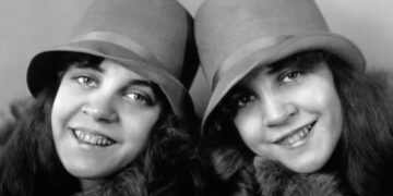 Σιαμαίες που η μία έμεινε έγκυος: Η μάγισσα, η μουσική καριέρα και το τέλος-Συναρπαστική ιστορία[video]