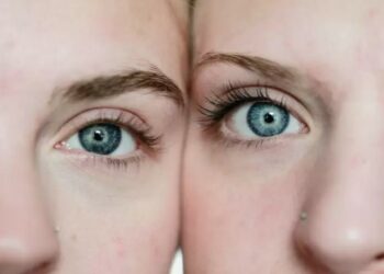 Αν συμβαίνει αυτό με τα φρύδια σας, κάντε εξετάσεις για διαβήτη!