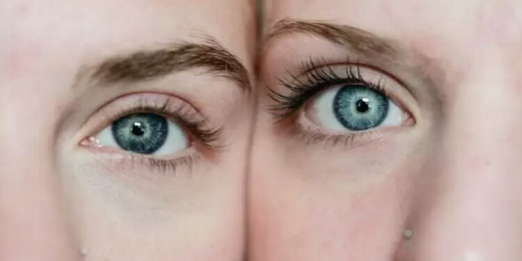 Alldaynews.gr Αν συμβαίνει αυτό με τα φρύδια σας, κάντε εξετάσεις για διαβήτη!