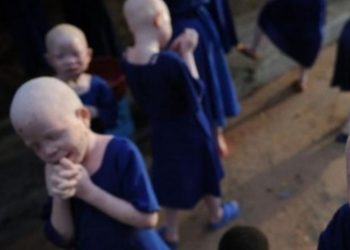 Φρίκη: Σκότωσαν και διαμέλισαν 4χρονο αλμπίνο για να μοιραστούν τα οστά του