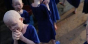 Φρίκη: Σκότωσαν και διαμέλισαν 4χρονο αλμπίνο για να μοιραστούν τα οστά του