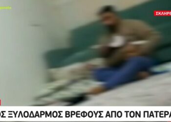 Alldaynews.gr Άγριος ξυλοδαρμός βρέφους από τον πατέρα του – Η μητέρα τον υποψιαζόταν και τον κατέγραψε με κάμερα (video)