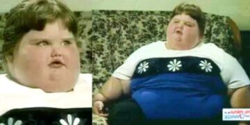 Η «παχύτερη 8χρονη στον κόσμο» που ζύγιζε 190 κιλά, έχασε τα 150 και πλέον μοιάζει με άγγελο[video]