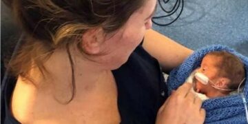 Alldaynews.gr Μαμά και προωράκι κινδύνεψαν στον τοκετό αλλά νίκησαν τον θάνατο μαζί!