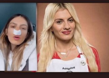 MasterChef – Ασημίνα: Το τρίτο χειρουργείο στη μύτη – «Δε μπορώ να αναπνεύσω καθόλου»