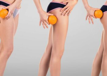 Κυτταρίτιδα: Οι ασκήσεις που την «εξαφανίζουν»