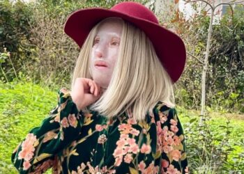 Η Ιωάννα Παλιοσπύρου μετά το χειρουργείο: Το περίεργο μικρόβιο που την ανάγκασε να κάνει νέα επέμβαση[photo]