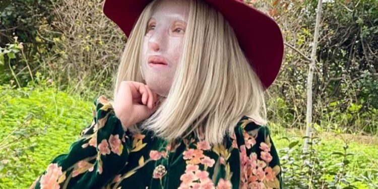 Η Ιωάννα Παλιοσπύρου μετά το χειρουργείο: Το περίεργο μικρόβιο που την ανάγκασε να κάνει νέα επέμβαση[photo]