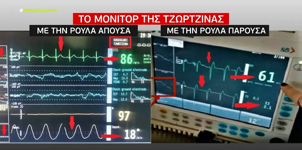 Ρούλα Πισπιρίγκου: Παρατεταμένη χορήγηση κεταμίνης ή δεύτερης ουσίας στη Τζωρτζίνα