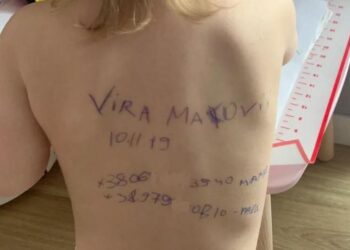 Πόλεμος στην Ουκρανία: Μητέρα έγραψε με στυλό στοιχεία και τηλέφωνα στην πλάτη του παιδιού της