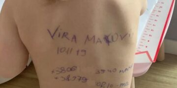 Alldaynews.gr Πόλεμος στην Ουκρανία: Μητέρα έγραψε με στυλό στοιχεία και τηλέφωνα στην πλάτη του παιδιού της