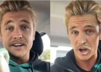 Έχω να λουστώ 6 χρόνια: Του έπεφταν τα μαλλιά, βρήκε το κόλπο που τον έσωσε και πλέον δεν χάνει τρίχα