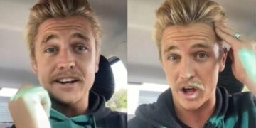 Έχω να λουστώ 6 χρόνια: Του έπεφταν τα μαλλιά, βρήκε το κόλπο που τον έσωσε και πλέον δεν χάνει τρίχα