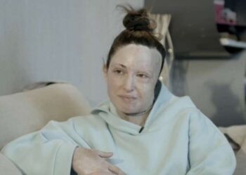 Ιωάννα Παλιοσπύρου: Η συνταρακτική συζήτησή της με τον ψυχίατρο της και τα 10 εφιαλτικά χειρουργεία