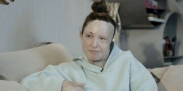 Ιωάννα Παλιοσπύρου: Η συνταρακτική συζήτησή της με τον ψυχίατρο της και τα 10 εφιαλτικά χειρουργεία