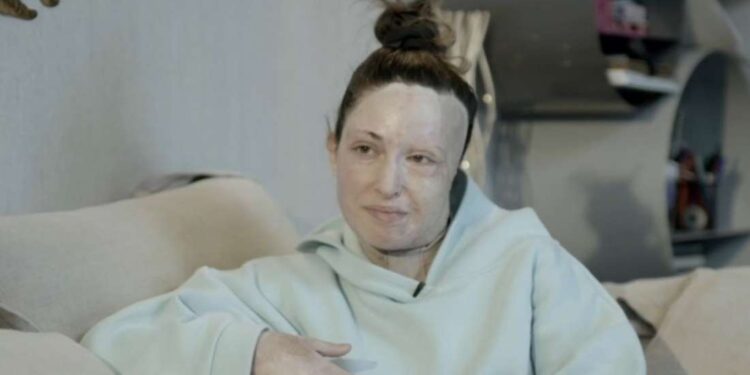 Ιωάννα Παλιοσπύρου: Η συνταρακτική συζήτησή της με τον ψυχίατρο της και τα 10 εφιαλτικά χειρουργεία