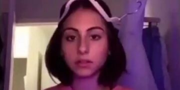 Alldaynews.gr Οι επιστήμονες για το «αντανακλαστικό της κρεμάστρας» που έχει γίνει viral – Θεραπεία για την αυχενική δυστονία; (vids)