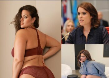 5 celebrities που «αγκάλιασαν» και πρόβαλαν τις ατέλειές τους![photos]