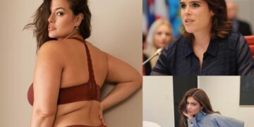 5 celebrities που «αγκάλιασαν» και πρόβαλαν τις ατέλειές τους![photos]