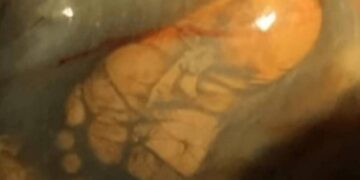 Alldaynews.gr Ήταν 9 μηνών έγκυος, αλλά δεν πήγε ποτέ στον γιατρό για εξετάσεις-Αυτό που έδειξε ο 1ος υπέρηχος, την έκανε να παγώσει!