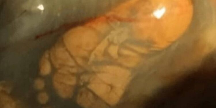 Alldaynews.gr Ήταν 9 μηνών έγκυος, αλλά δεν πήγε ποτέ στον γιατρό για εξετάσεις-Αυτό που έδειξε ο 1ος υπέρηχος, την έκανε να παγώσει!