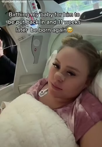 Γυναίκα στη Βρετανία γέννησε το ίδιο μωρό δύο φορές μέσα σε 3 μήνες![video]