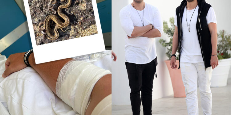 Droulias Brothers: Δάγκωσε φίδι τον Ηλία Δρούλια – Μεταφέρθηκε με αεροδιακομιδή στην Αθήνα από τη Μύκονο