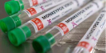 Alldaynews.gr Μόσιαλος για Ευλογιά των πιθήκων: «Δεν είναι η νόσος των γκέι»