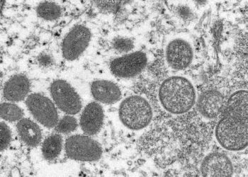 Alldaynews.gr Ευλογιά των πιθήκων: «Καμπανάκι» του ΠΟΥ – «Ο ιός θα εξαπλωθεί στην Ευρώπη το καλοκαίρι»