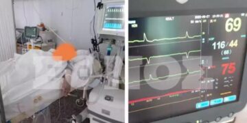 Alldaynews.gr «Πνίγονται» ξανά από ράντζα τα νοσοκομεία – Διασωληνωμένοι και εκτός ΜΕΘ