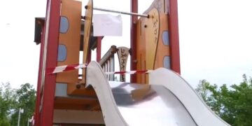 Alldaynews.gr Άριστη η κατάσταση του δακτύλου της 8χρονης – Τι λέει o πλαστικός χειρουργός που τη χειρούργησε (video)