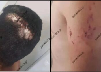 Κρήτη: Υπάλληλος ζήτησε τον μισθό του και στο δρόμο για το Τμήμα τον βρήκε ο εργοδότης και τον σακάτεψε (φωτο)