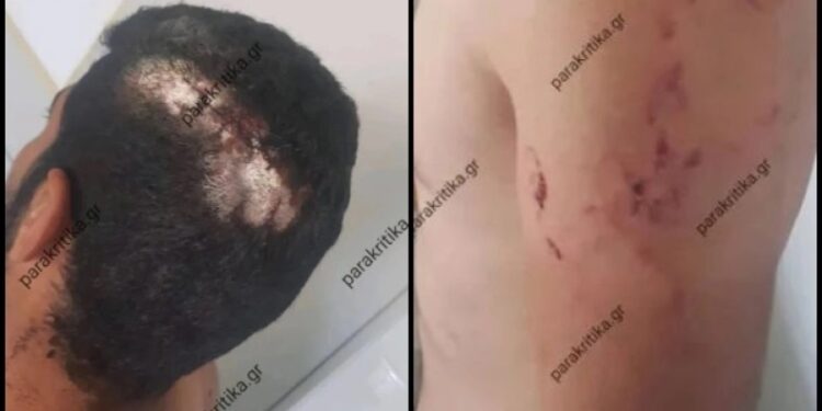 Κρήτη: Υπάλληλος ζήτησε τον μισθό του και στο δρόμο για το Τμήμα τον βρήκε ο εργοδότης και τον σακάτεψε (φωτο)