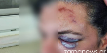 Πήραν ταξί επειδή ήπιαν παραπάνω, τράκαραν και κατέληξαν στο νοσοκομείο (φωτο)