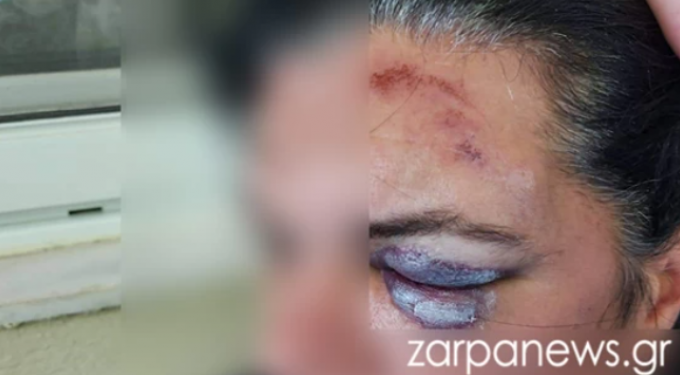 Πήραν ταξί επειδή ήπιαν παραπάνω, τράκαραν και κατέληξαν στο νοσοκομείο (φωτο)