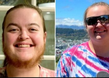 Η γυναίκα που αφήνει το μούσι της να μεγαλώσει: «Με αποκαλούν φρικιό, αλλά δεν μετανιώνω»