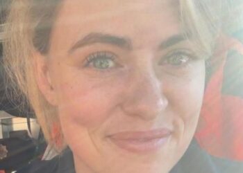 Η «αόρατη ασθένεια» που αναγκάζει 33χρονη να πηγαίνει τουαλέτα 30 φορές την ημέρα