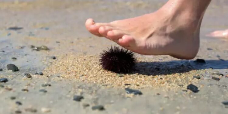 Alldaynews.gr Προσοχή! Δεν είναι απλό-Τι να κάνετε αν πατήσετε αχινό