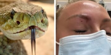 Φίδι δάγκωσε γυναίκα στο πρόσωπο[video]