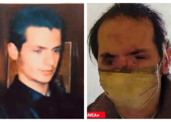 Θύμιος Μπουγάς: Η συγκλονιστική εξιστόρηση για το ατύχημα-”Mετά το νοσοκομείο, είχα έναν φίλο αλλά έφυγε”[video]