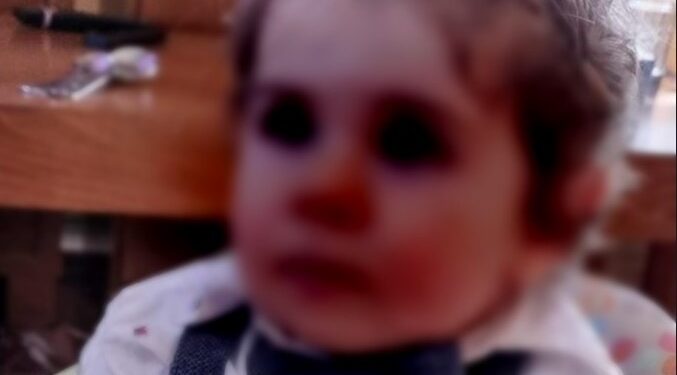 «To θαύμα έγινε! H καρδούλα τoυ Πολυχρόνη θα λειτουργεί και θα μεγαλώνει φυσιολογικά από μόνη της»