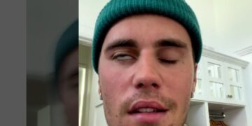 Alldaynews.gr Justin Bieber: Πάσχω από Ramsay Hunt, παρέλυσε το πρόσωπό μου (video)
