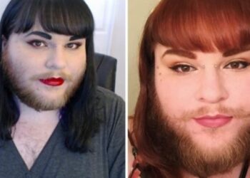 Χώρισε τη γυναίκα του επειδή της έβγαλε την μαντίλα και ανακάλυψε ότι έχει μούσι