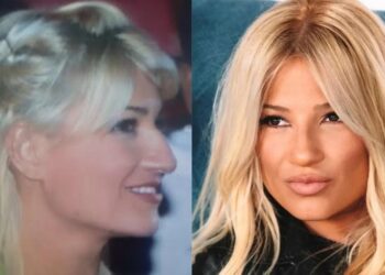 Alldaynews.gr Σκορδά, Μακρυπούλια, Λέχου: 20 διάσημες Ελληνίδες που έκαναν πλαστική στο πρόσωπο και δεν το παραδέχτηκαν ποτέ