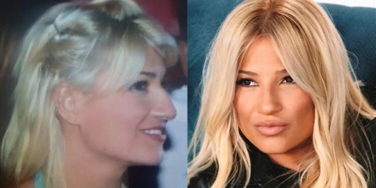 Alldaynews.gr Σκορδά, Μακρυπούλια, Λέχου: 20 διάσημες Ελληνίδες που έκαναν πλαστική στο πρόσωπο και δεν το παραδέχτηκαν ποτέ