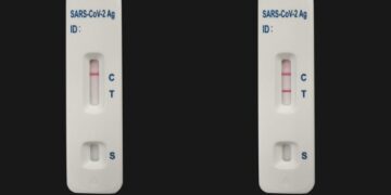 Όμικρον 4-5: Αυτά είναι τα σημάδια στο σώμα που φωνάζουν ότι κόλλησες ακόμα κι αν το τεστ σου είναι αρνητικό
