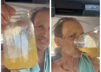 Άνδρας πίνει εδώ και 20 χρόνια τα ούρα του για πρωινό και αυτά έχει να πει