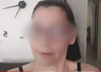 Επίθεση με οξύ στη Μεσσήνη: «Έχει κάνει ζημιά στο δεξί μάτι» – Τι λέει η 49χρονη που δίνει μάχη για την όρασή της[video]